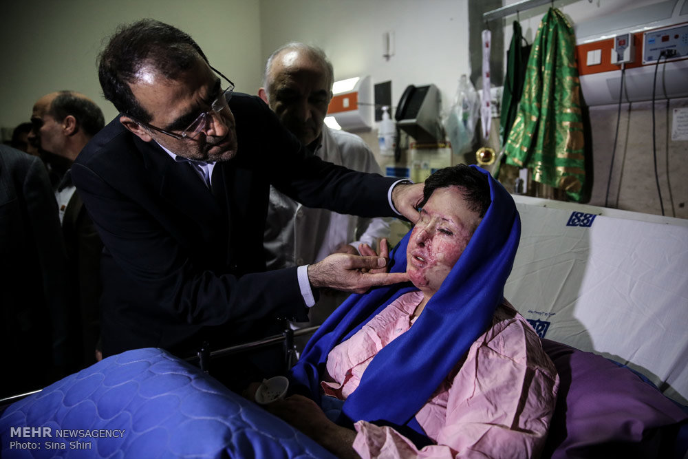 سهیلا جورکش ، قربانی اسیدپاشی اصفهان: برایم دعا کنید http://media.mehrnews.com/d/2015/01/17/4/756656.jpg?ts=1440157862632