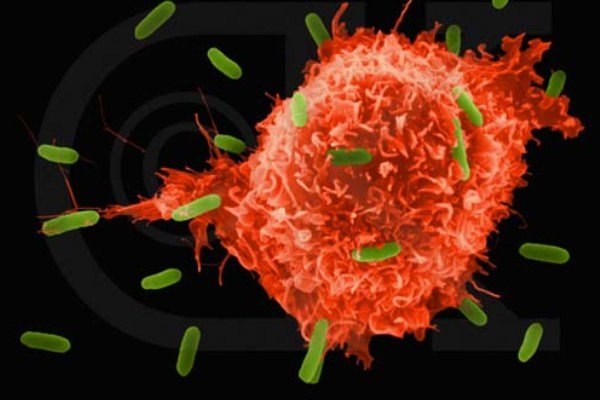 ویتامین D دلیل مقاومت سرطان پانکراس در برابر شیمی درمانی