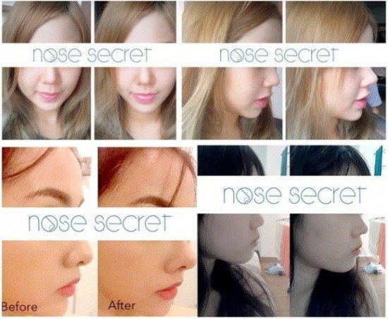 nose-secret-550x453.jpg