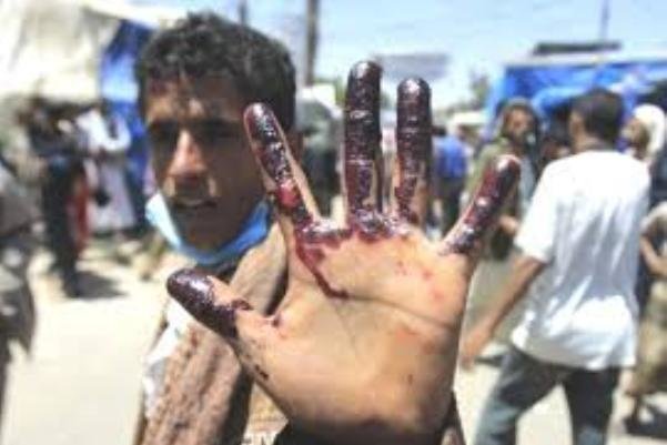 ۹۴۴ کشته و ۳۴۸۷ زخمی جدیدترین آمار بهداشت جهانی از یمن