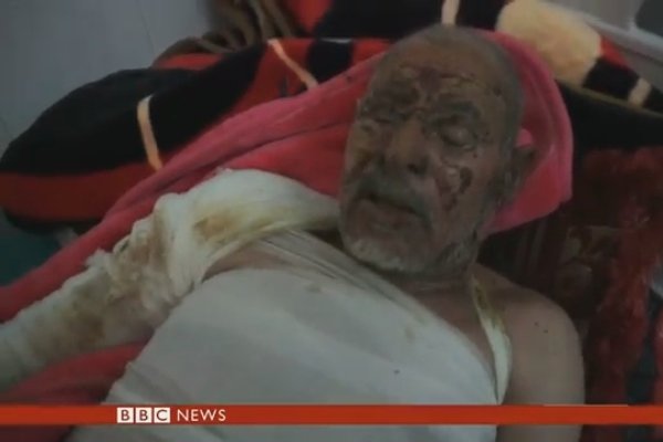 فیلم/ وضعیت یمن در سومین هفته از حملات عربستان