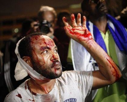 زخمی شدن 7 پليس اسرائيلی در درگيری با تظاهرات كنندگان