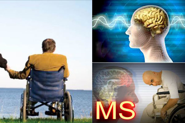 تشکیل انجمن بیماران «ام اس» شهرستان گلپایگان بیماری ام اس