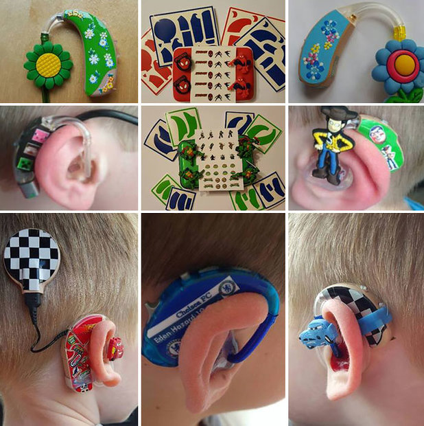 hearing-aid-decorations-kids-cochlear-implant-sarah-ivermee-lugs-7.jpg