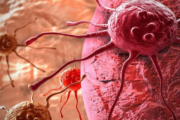 انفجار نانوحباب حاوی دارو درون تومور سرطان کبد