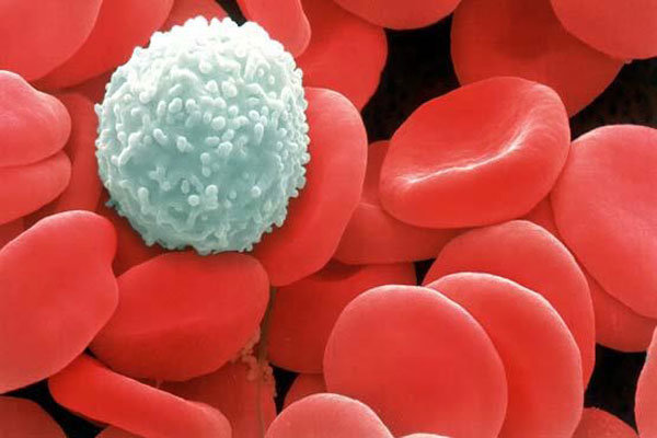 مصرف ویتامین C روند پیشرفت سرطان خون را متوقف می کند