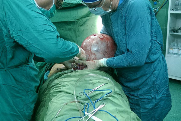 عمل جراحی