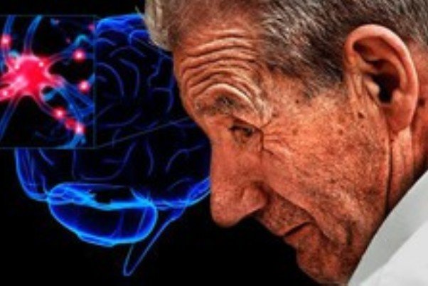 چیزی به درمان پارکینسون و اختلالات عصبی نمانده است پارکینسون و سلول های بنیادی