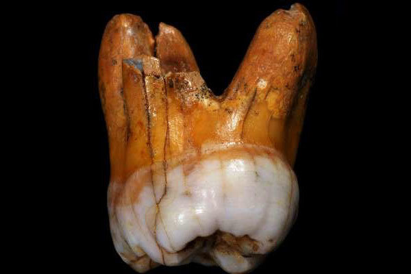 دندان باستانی