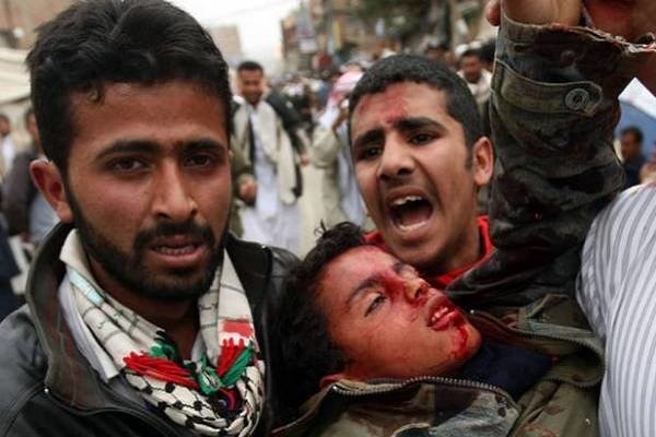 حمله آل سعود به یمن