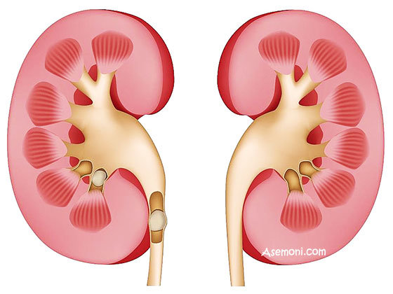 learn-more-about-kidney2.jpg