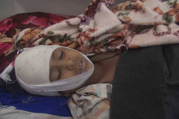 شهادت کودک یمنی