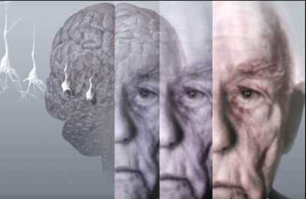 ارتباط آلزایمر با عملکرد نامناسب مکانیسم های حمل و نقل عصبی