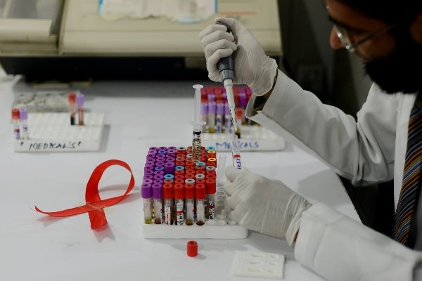 یک راه حل جدید برای درمان ایدز/ واکسنی با توانایی کشتن ویروس