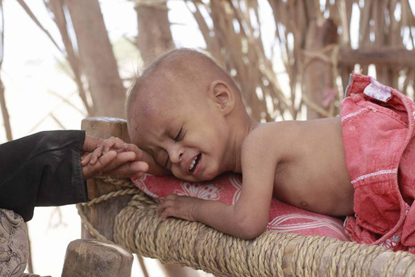 صلیب سرخ جهانی: ۶۰۰ هزار یمنی در معرض ابتلا به وبا قرار دارند