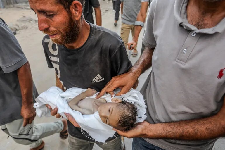 بحران گرسنگی در غزه از دریچه دوربینها؛ مرگ تدریجی کودکان بیگناه