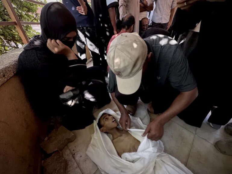 بحران گرسنگی در غزه از دریچه دوربینها؛ مرگ تدریجی کودکان بیگناه