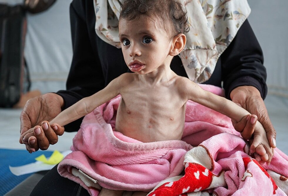 بحران گرسنگی در غزه از دریچه دوربینها؛ مرگ تدریجی کودکان بیگناه