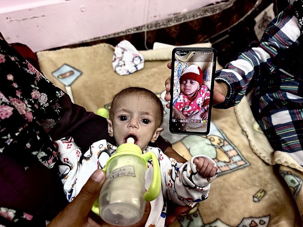 بحران گرسنگی در غزه از دریچه دوربینها؛ مرگ تدریجی کودکان بیگناه