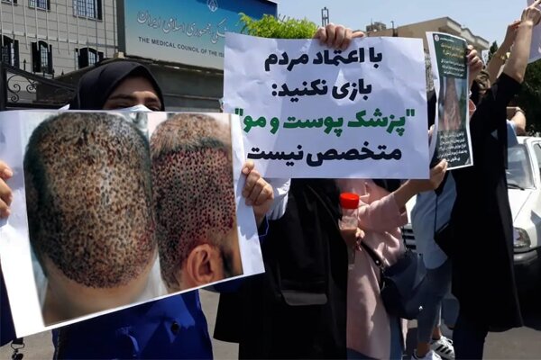 هزینهای فراتر از پول؛ پشت پرده کاشت موهای ناموفق در مراکز غیرمجاز هزینهای فراتر از پول؛ پشت پرده کاشت موهای ناموفق در مراکز غیرمجاز