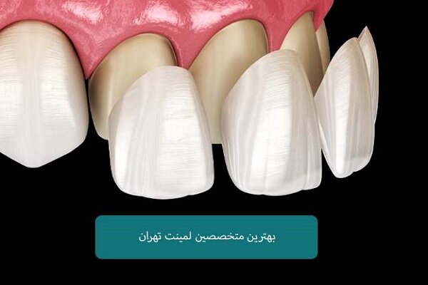 اسامی متخصصین لمینت دندان تهران اسامی متخصصین لمینت دندان تهران