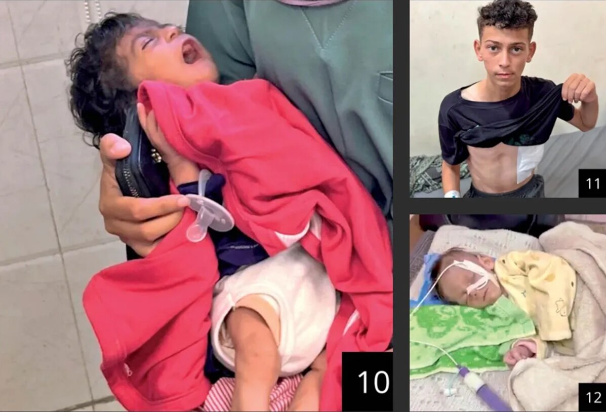 اذعان «هاآرتص» به فجایع غزه؛ همه جا را گرسنگی فراگرفته است+ تصاویر