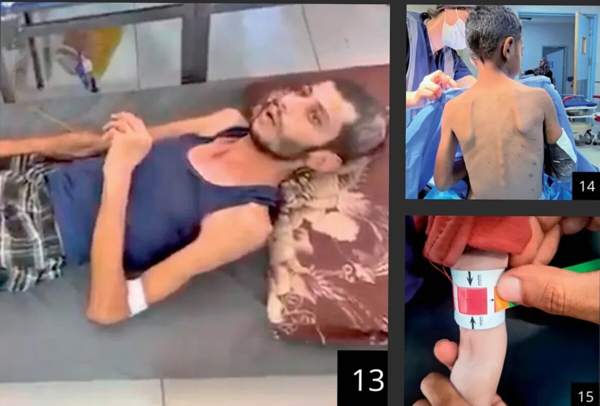 اذعان «هاآرتص» به فجایع غزه؛ همه جا را گرسنگی فراگرفته است+ تصاویر