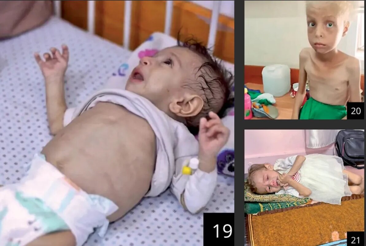 اذعان «هاآرتص» به فجایع غزه؛ همه جا را گرسنگی فراگرفته است+ تصاویر