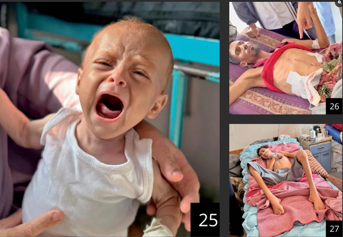 اذعان «هاآرتص» به فجایع غزه؛ همه جا را گرسنگی فراگرفته است+ تصاویر