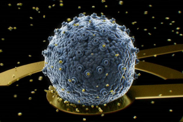 راهکار تشخیص دقیق بیماریهای خوش خیم و بدخیم پروستات
راهکار تشخیص دقیق بیماریهای خوش خیم و بدخیم پروستات