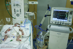 طرح تفکیک نوزادان بیمار در ۲۶ شهر اصفهان کلید خورد
