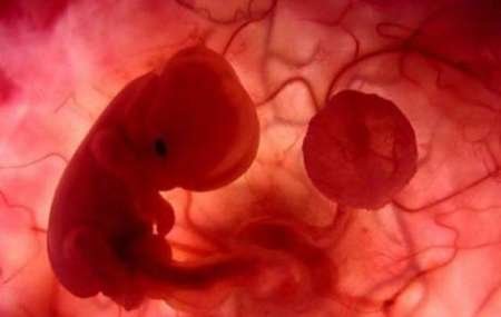 بررسی تاثیر تغییرات جریان خون رحمی در سقط مکرر