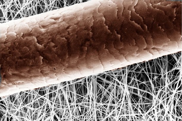 Plant nanofibers to treat diabetic ulcers