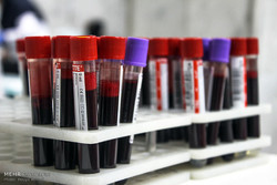 اهدای خون در کرمانشاه طی شب های قدر ۲۱ درصد افزایش یافت
