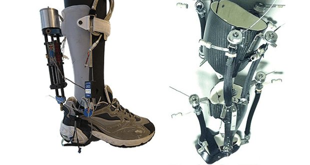 Powered knee-ankle-foot orthosis for poliomyelitis patients