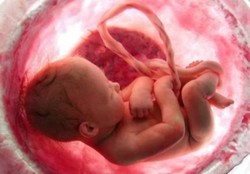 عوامل پرخطر سقط جنین را بشناسید