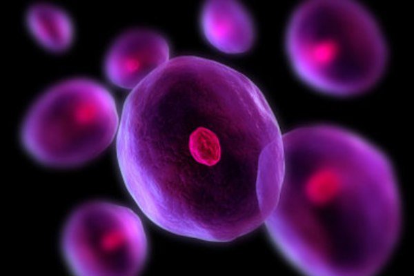 سلول های بنیادی مغز در بیماران مبتلا به ام اس پیرتر هستند سلول های بنیادی مغز در بیماران مبتلا به ام اس پیرتر هستند