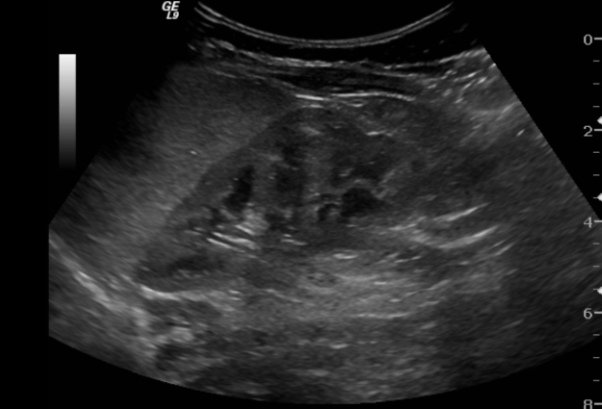 خطرات انجام سونوگرافی‌های بی‌مورد برای زنان باردار
