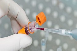 تشخیص میزان عمر بیماران مبتلا به سرطان با آزمایش خون