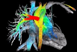 این فناوری ام آر آی قلب را در تاریخ بایگانی می‌کند