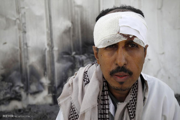 ویرانی های جنگ یمن‎