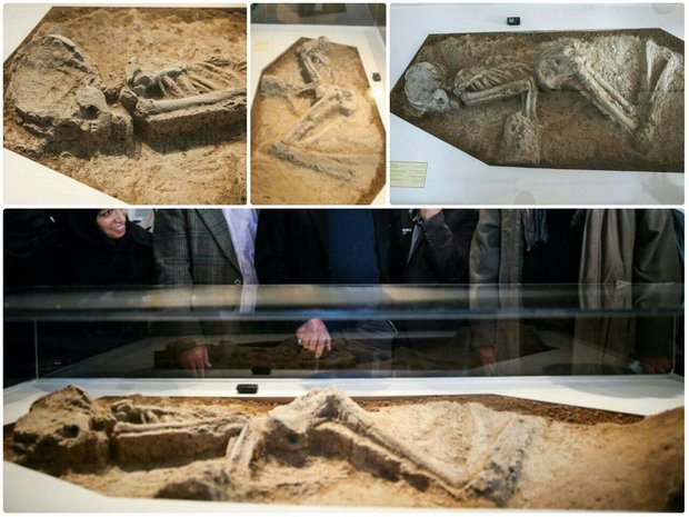 Tehran’s 7,000-year-old woman had infection 