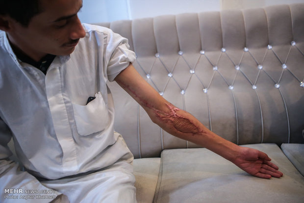 معالجة الجرحى اليمنيين في مستشفيات طهران