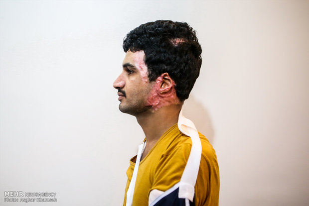 Injured people of Yemen in Tehran
