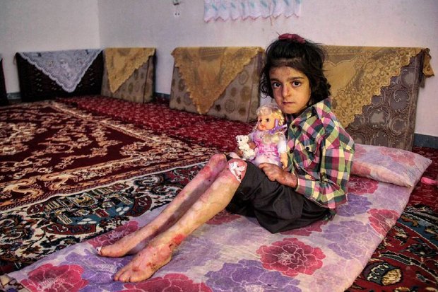 بیماران «پروانه ای» را بیشتر بشناسید بیماران «پروانه ای» را بیشتر بشناسید