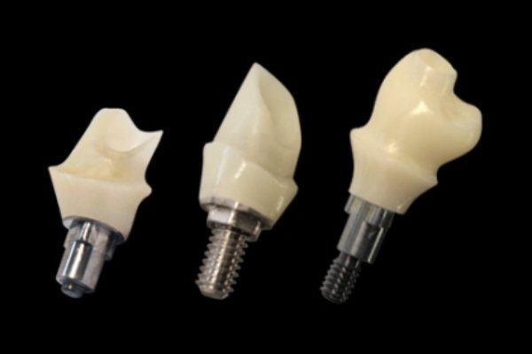 استفاده از ایمپلنت های نوین برای سالمندان فاقد دندان