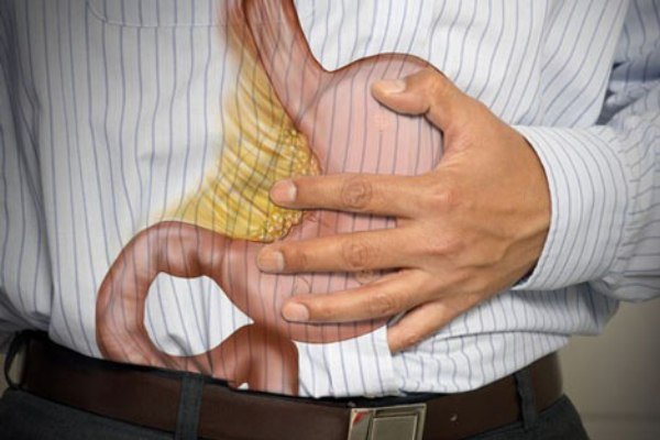 Researchers find more effective treatment for stomach ulcers