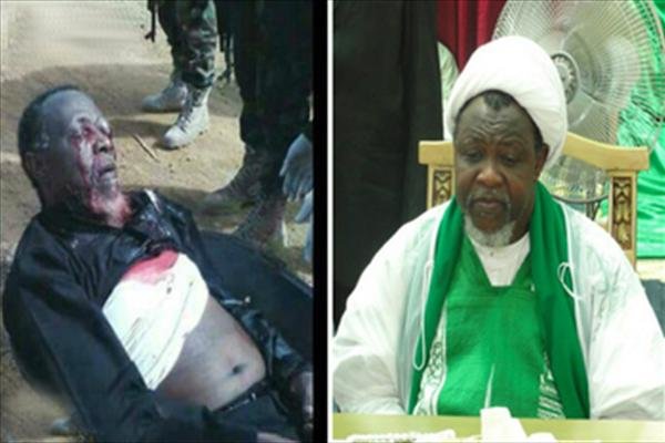 IHRC urges immediate access to medical treatment for Zakzaky