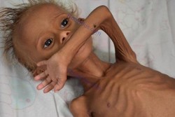 فیلم/ قحطی و گرسنگی در استان الحدیده یمن