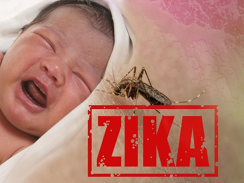 تاثیر ویروس زیکا در بارداری بر سیستم ایمنی کودک